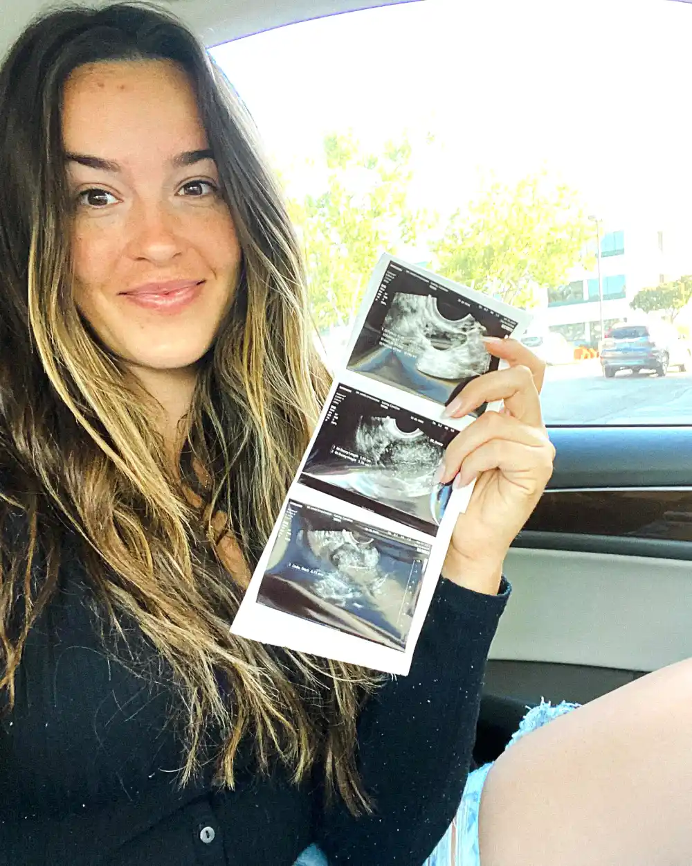 Bachelor&rsquo;s Caroline Lunny Details Fertility Journey After 8 Surgeries: &lsquo;I Want to Be a Mom&rsquo;