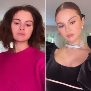 Selena Gomez Shows Off Before After Transformation SAG Awards Watch