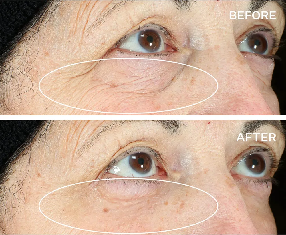 StriVectin Hyperlift Eye Instant Eye Fix