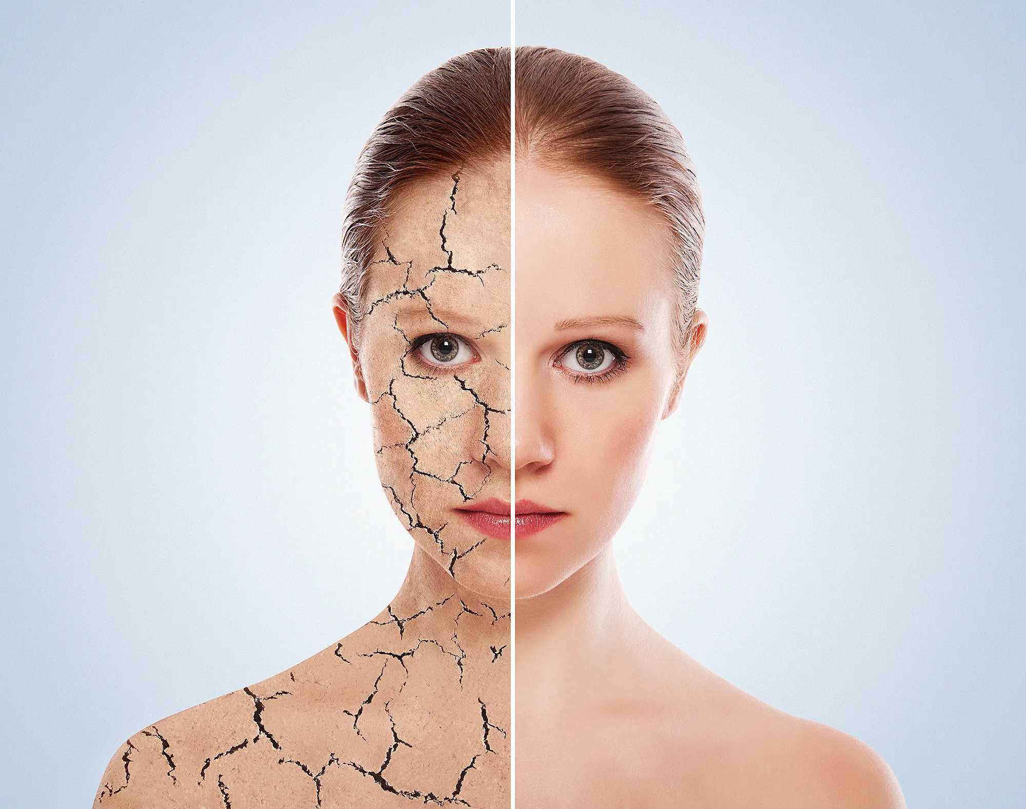 dry-skin-before-after