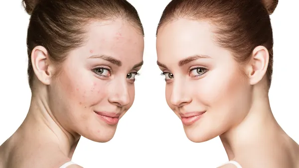 tula-breakout-breakthrough-toner-pads