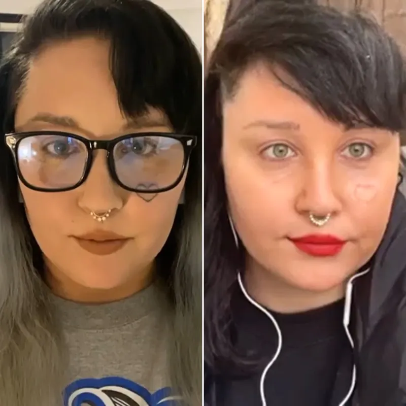 Amanda Bynes Is Getting the Heart-Shaped Tattoo on Her Face Removed Ahead of Conservatorship Hearing