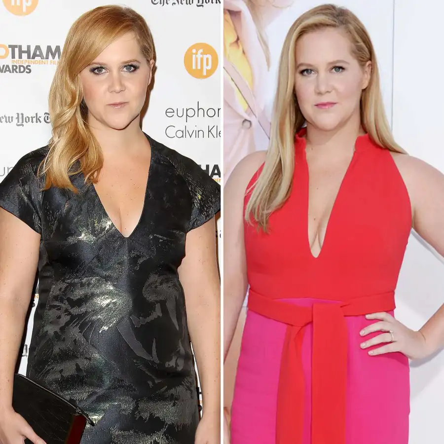 Celebrities Who Admitted They Got Plastic Surgery