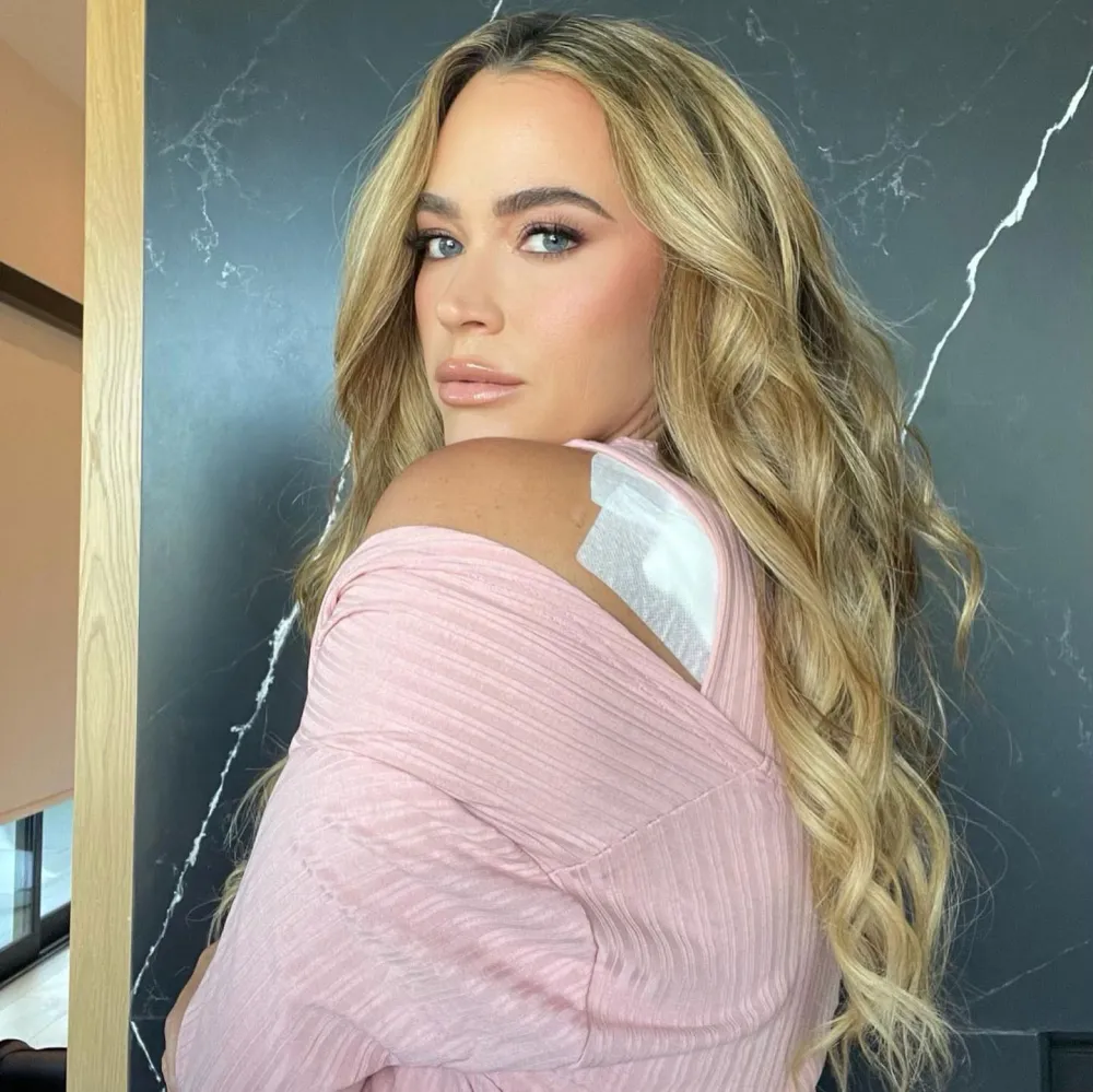 RHOBH Teddi Mellencamp Has a Skin Cancer Scare