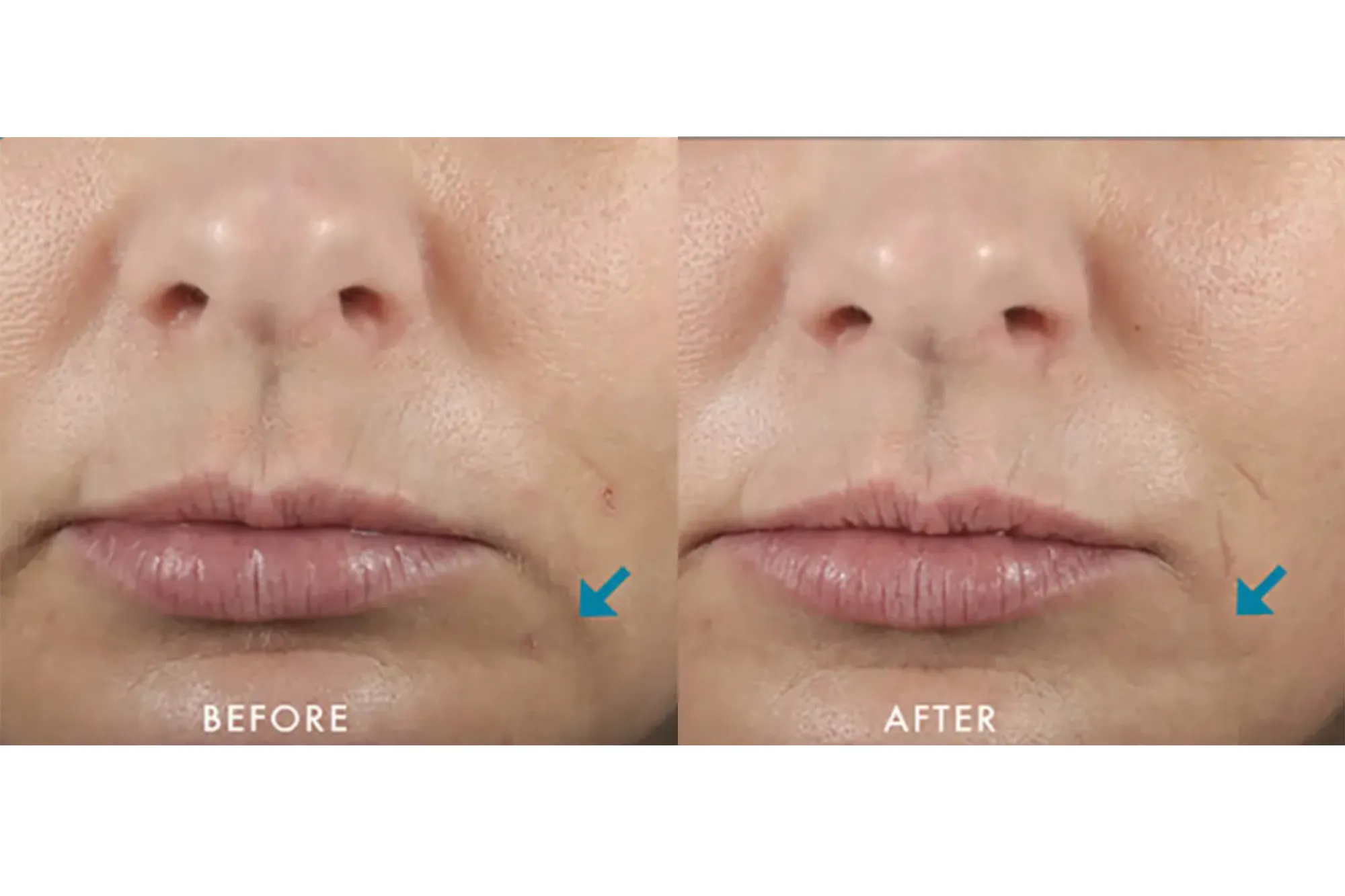 SkinCeuticals Hyaluronic Acid Intensifier