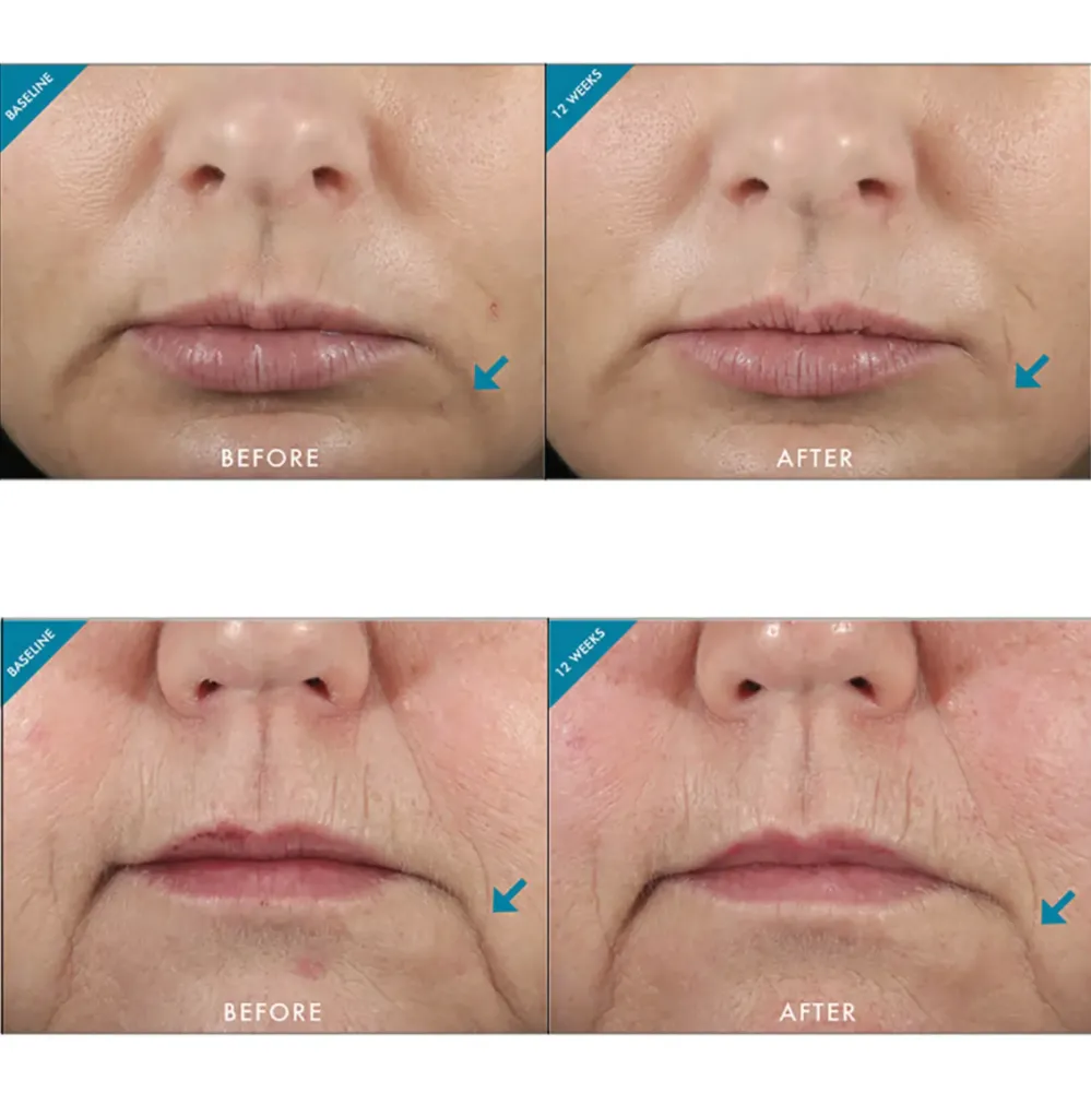 SkinCeuticals Hyaluronic Acid Intensifier