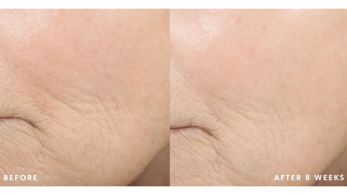 SkinCeuticals Triple Lipid Restore 242