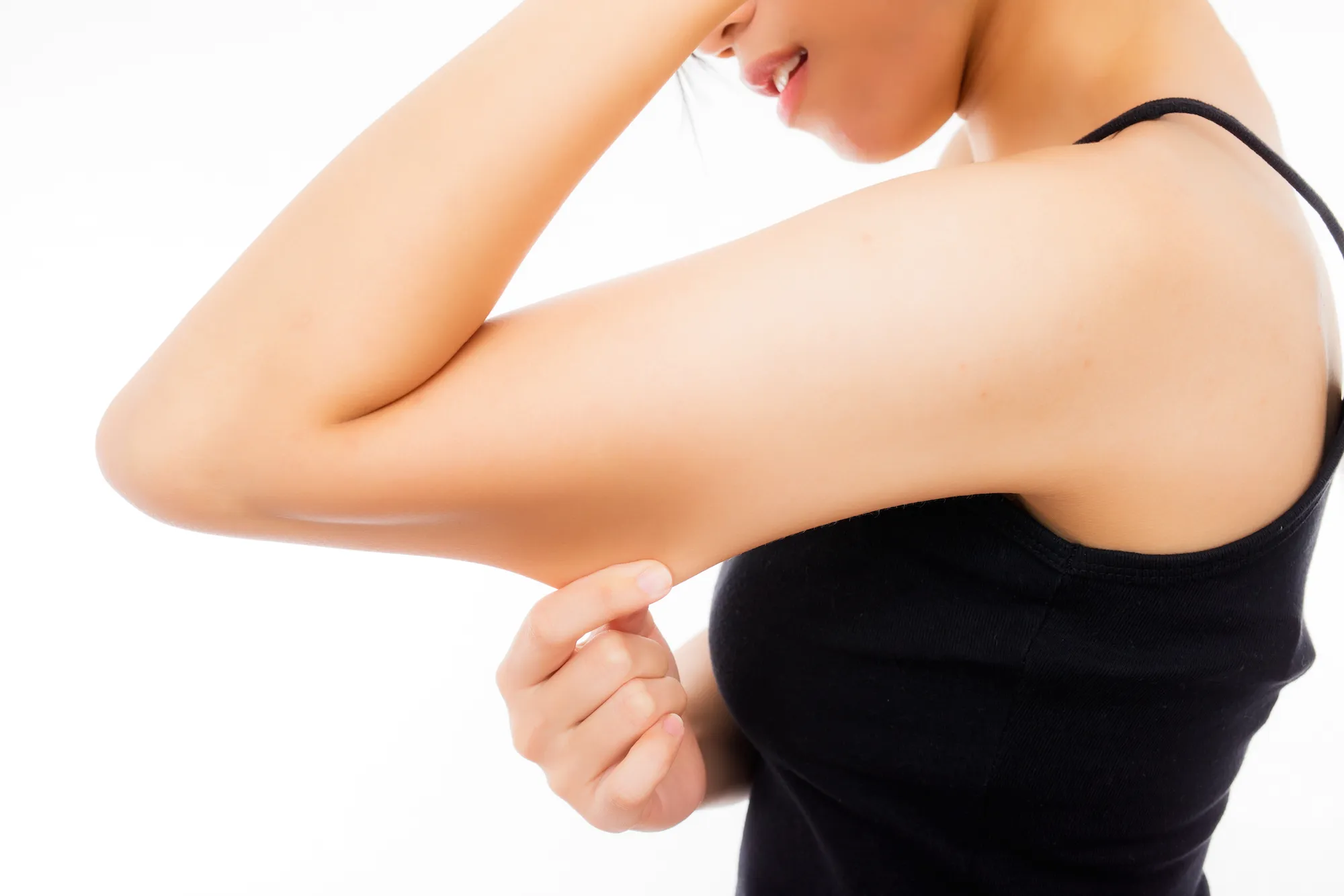 Woman-Pinching-Arm-Skin-Stock-Photo