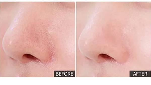 before and after primer