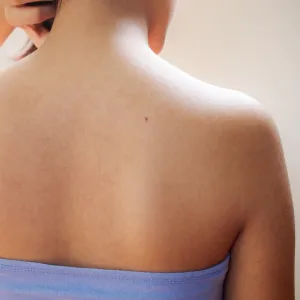 best-body-wash-for-acne-before-after