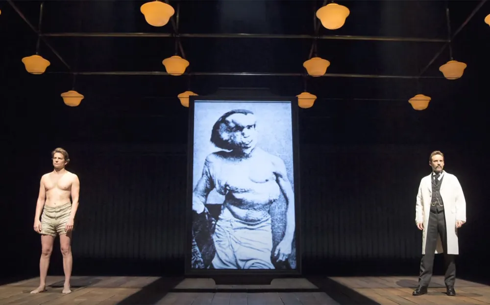 Bradley Cooper Transforms Into the Elephant Man on Broadway Without Makeup or Prosthetics Watch Now 0001