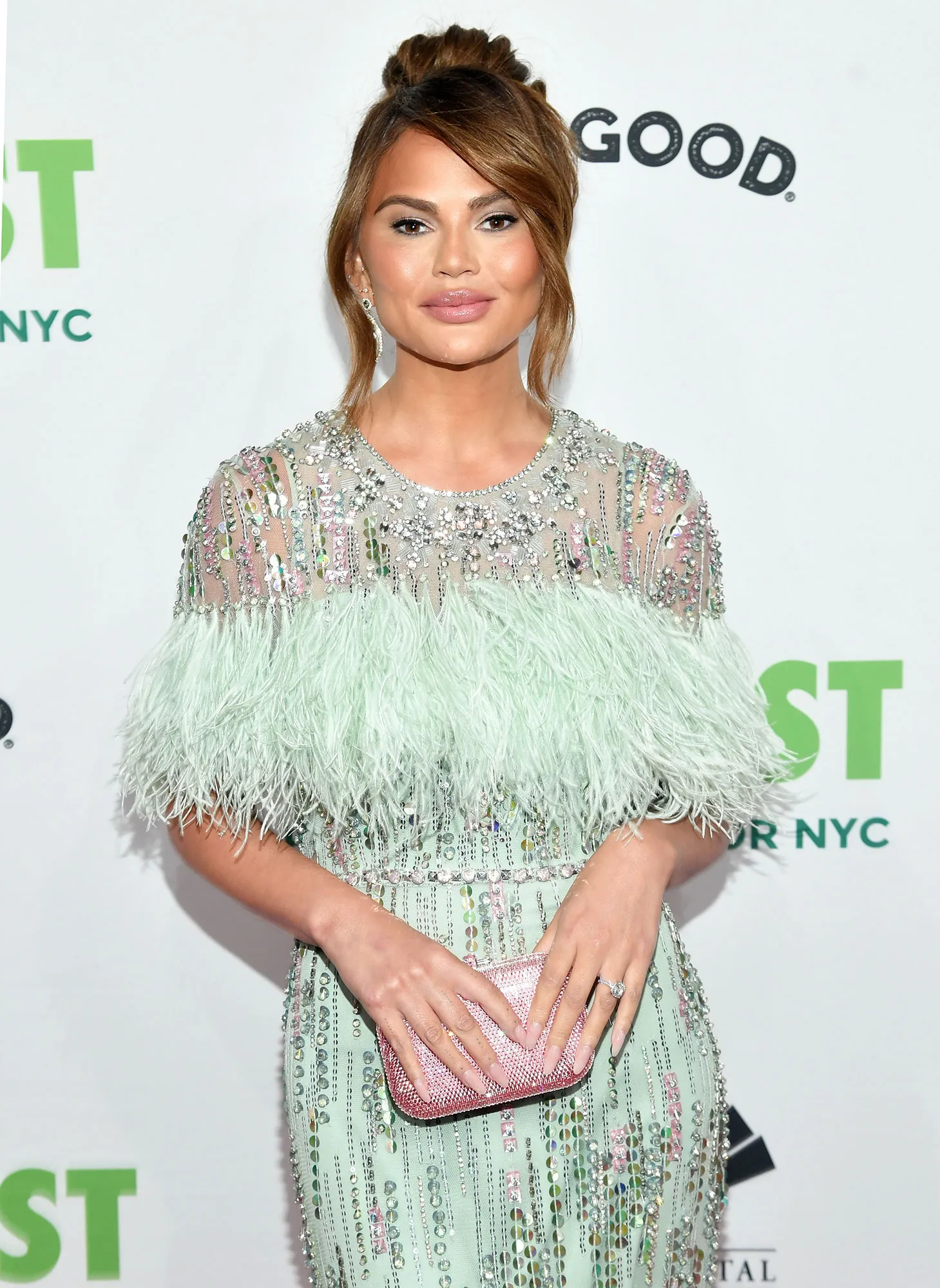 Chrissy Teigen Calls Out Fan Who Claims She Gets Constant Liposuction