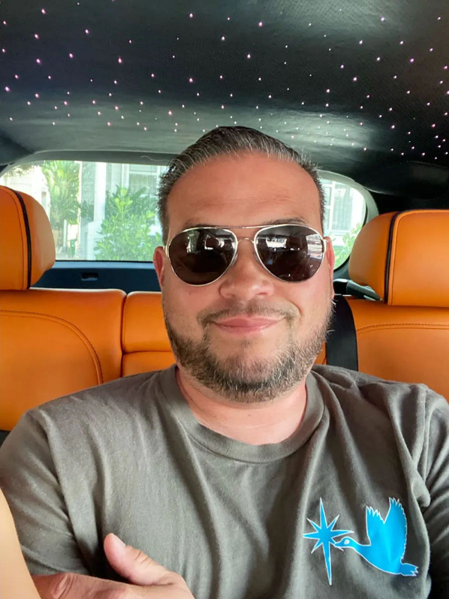 Jon Gosselin Is Thrilled With Hair Transplant Before After Pics