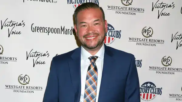 Jon Gosselin Is Thrilled With Hair Transplant Before After Pics