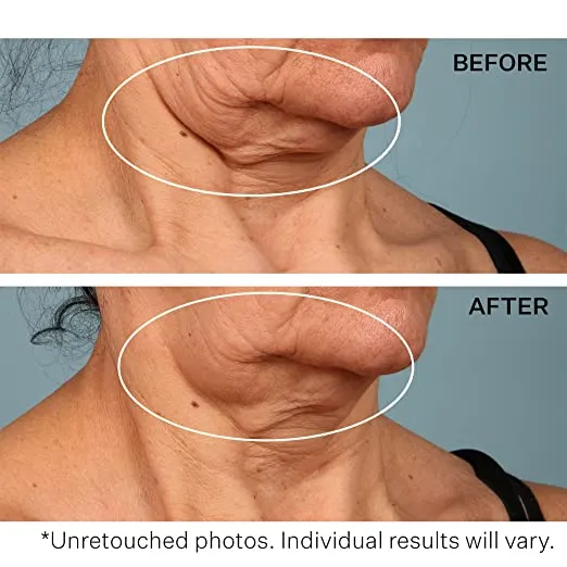 StriVectin Tighten & Lift Advanced Neck Cream