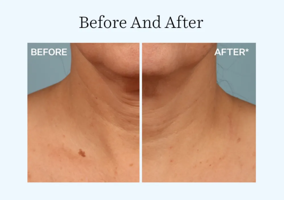 StriVectin Tighten & Lift Advanced Neck Cream