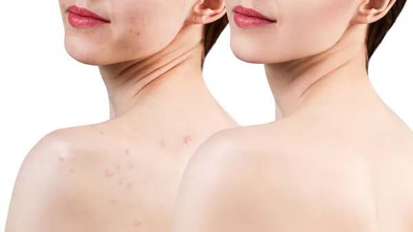 versed-firm-ground-retinol-body-lotion