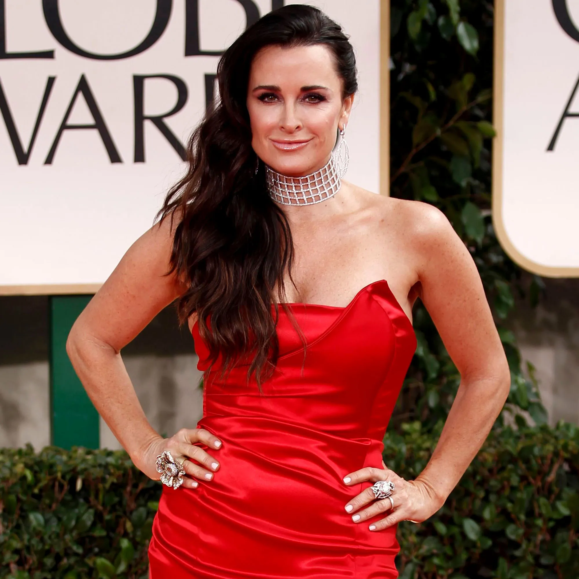 Kyle Richards’ Most Honest Quotes About Plastic Surgery