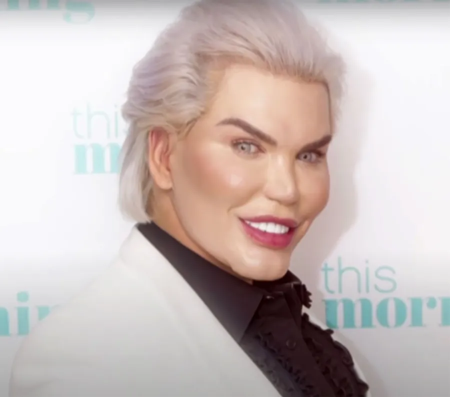Meet 7 Real-Life Barbie and Ken Dolls Rodrigo Alves