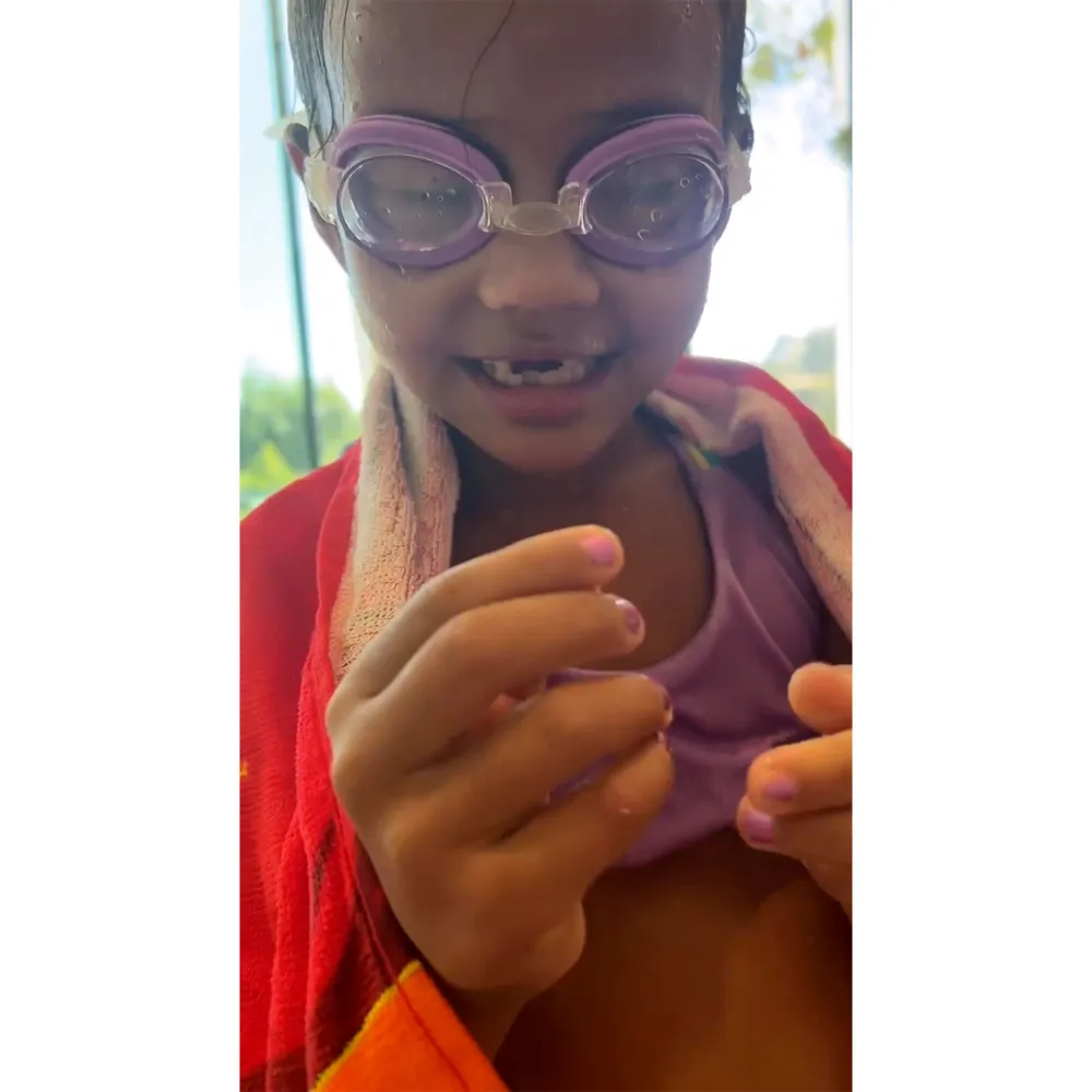 Tooth Fairy Time! Chrissy Teigen's Son Miles Knocks Sister Luna's Tooth