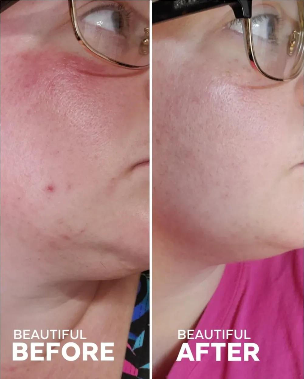 Radiance Grape Stem Cell + Squalane Day Cream