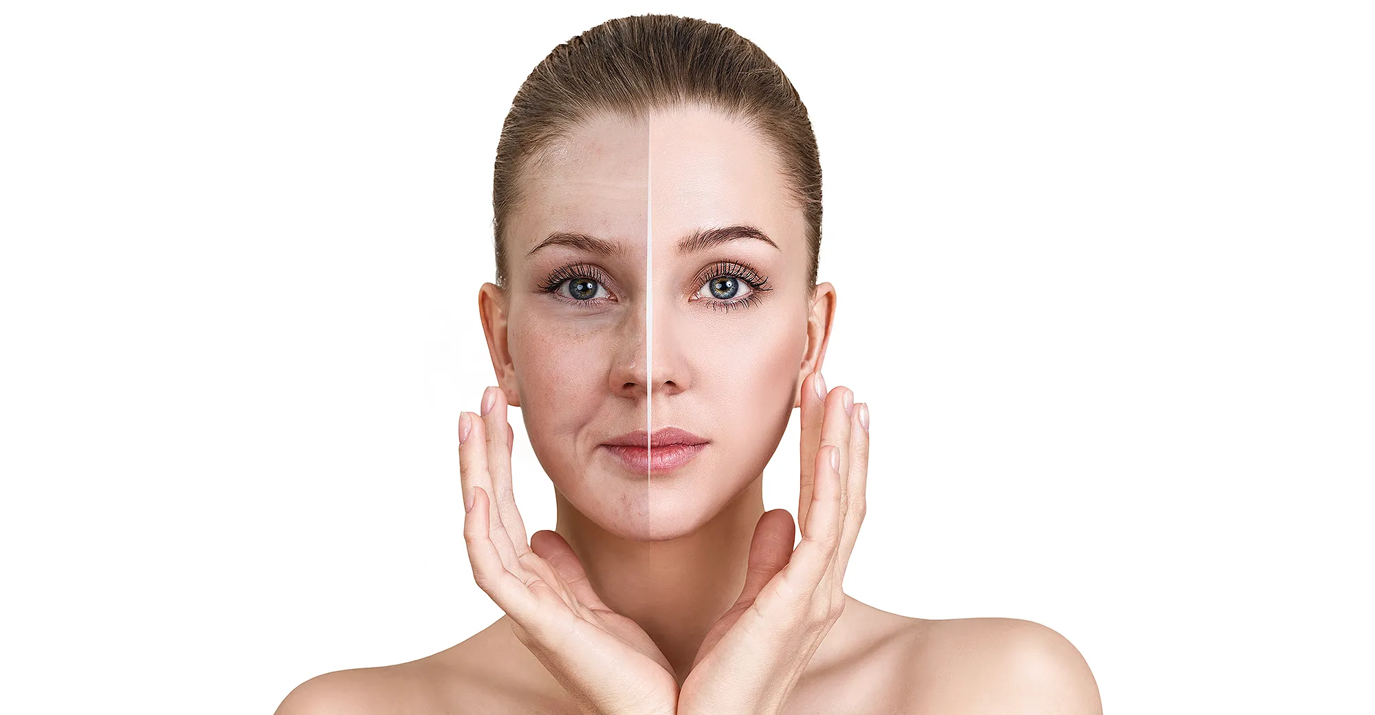 dry-skin-before-after