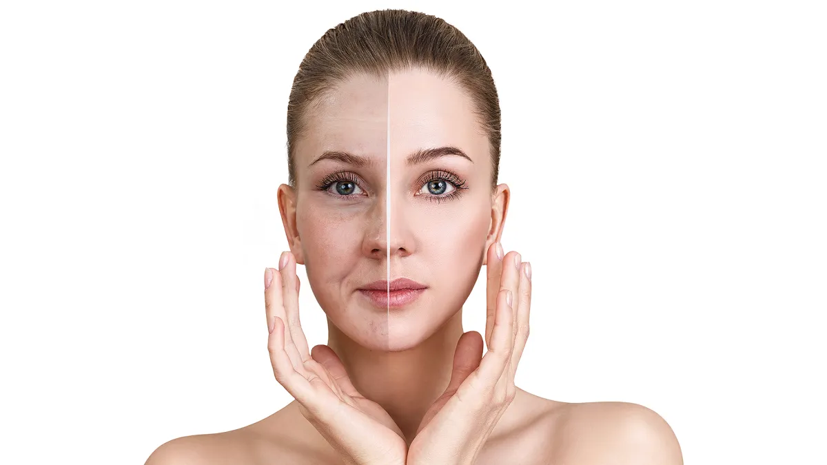 dry-skin-before-after