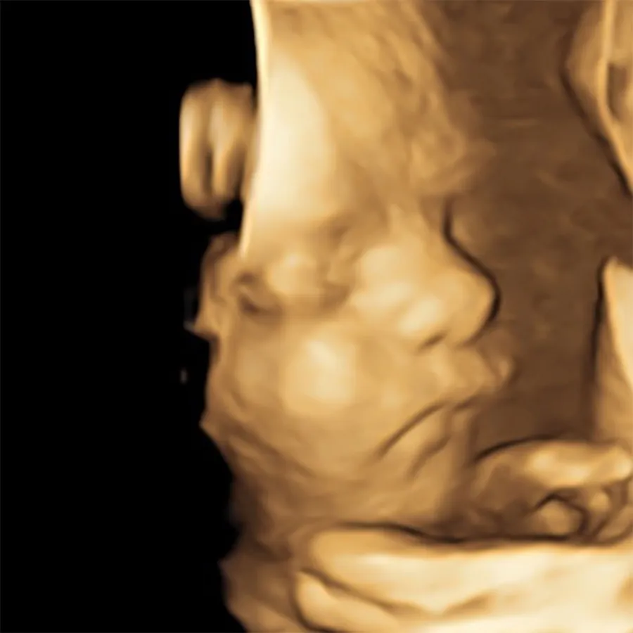 Hilaria Baldwin Shares Sonogram of Baby No. 8 With Alec Baldwin