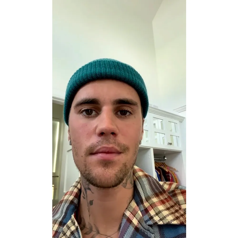 Justin Bieber to Resume Tour Amid Ramsay Hunt Syndrome Diagnosis