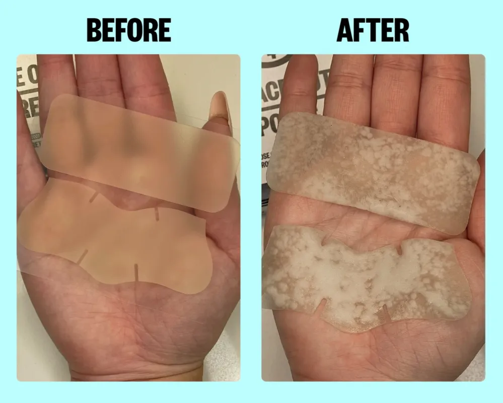 Oil-Absorbing Pore Strips