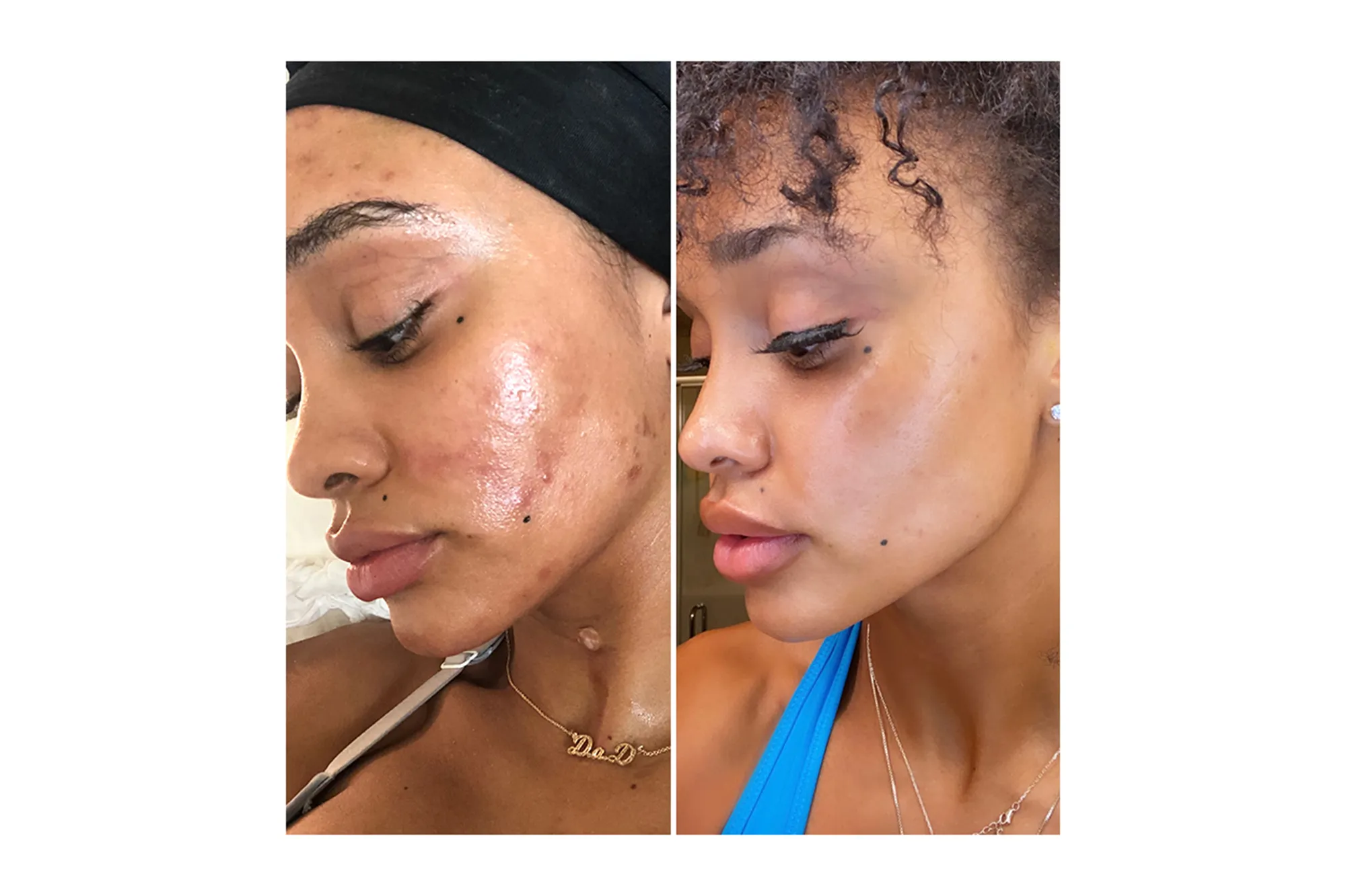 Gleamin before and after