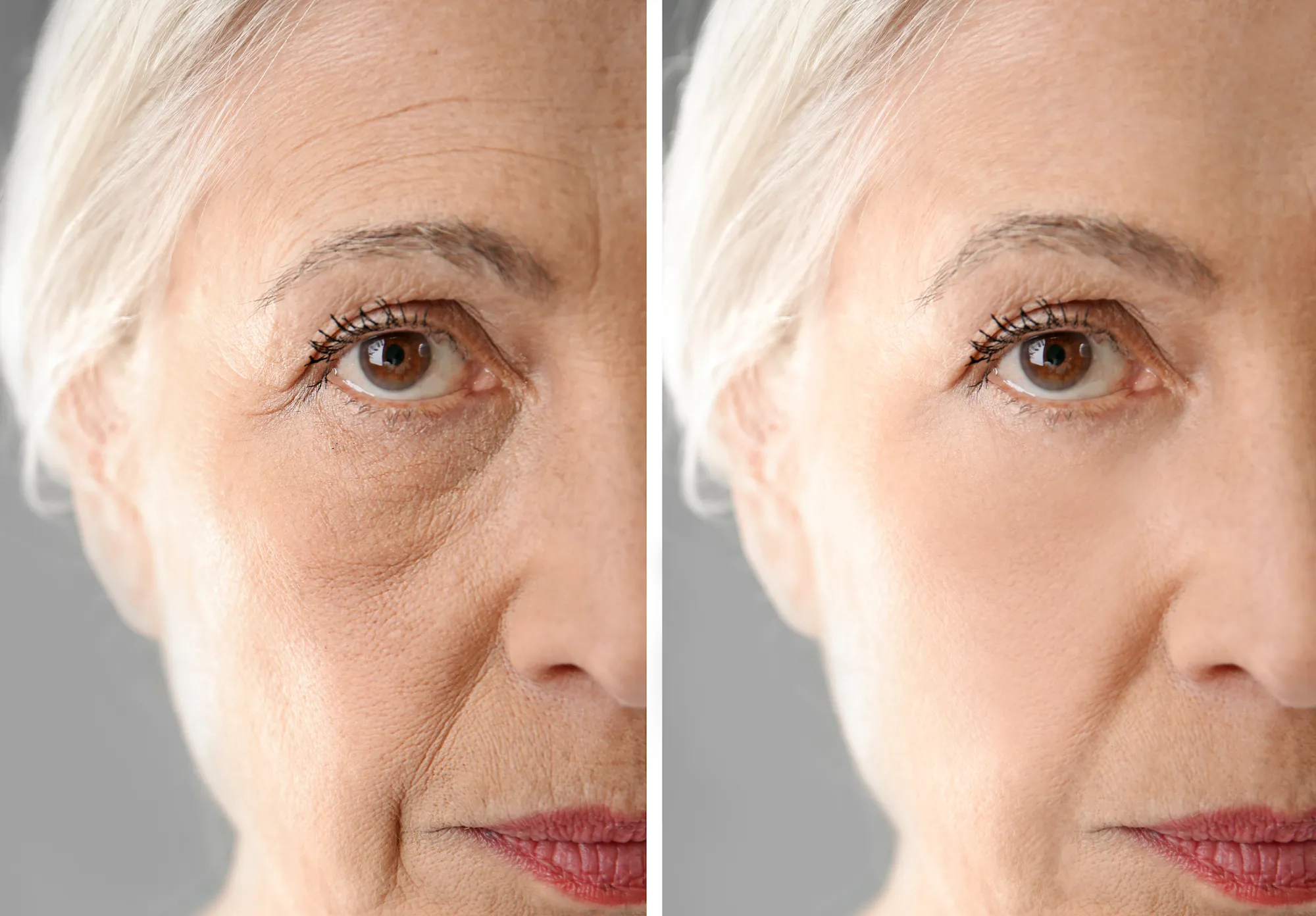 Anti-Aging-Before-After-Stock-Photo