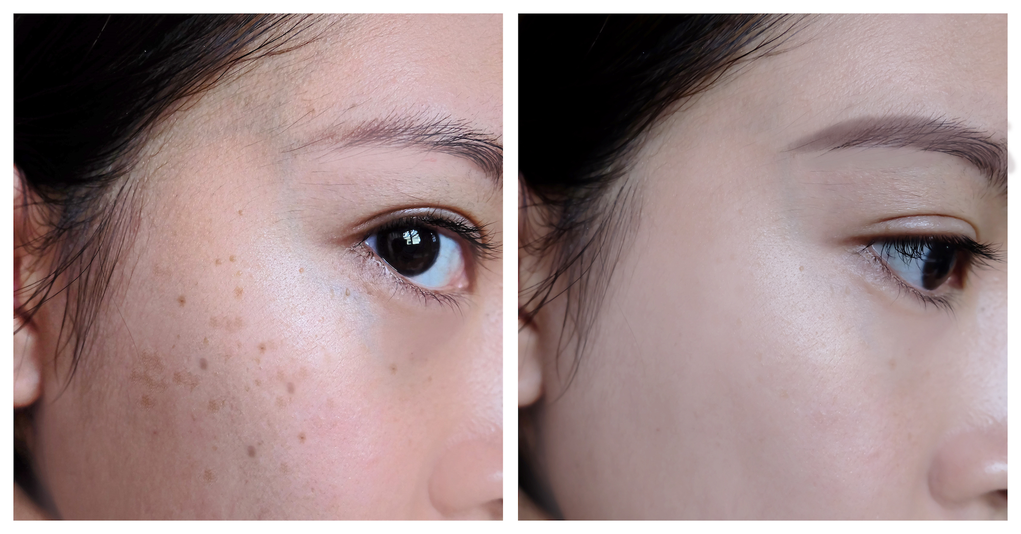 Before-After-Skin-Glow-Stock-Photo