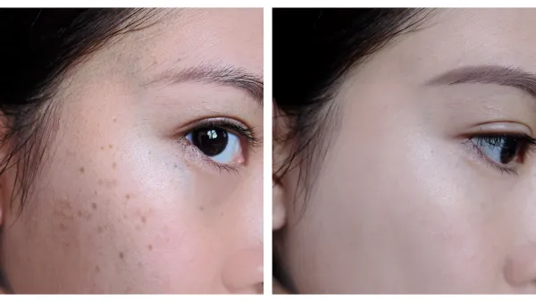Before-After-Skin-Glow-Stock-Photo