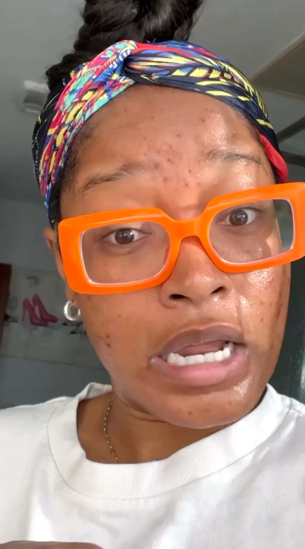 Keke Palmer Talks Dealing With Adult Acne