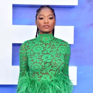 Keke Palmer Talks Dealing With Adult Acne