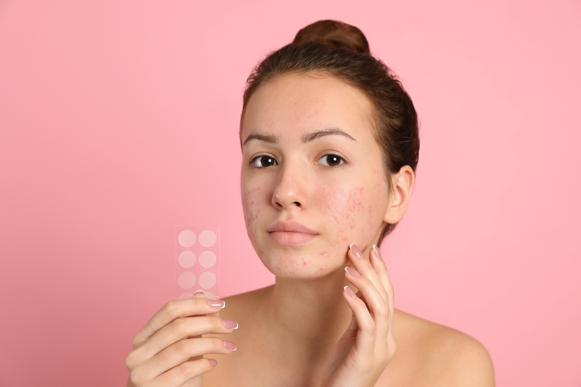 Pimple-Dots-Stock-Photo