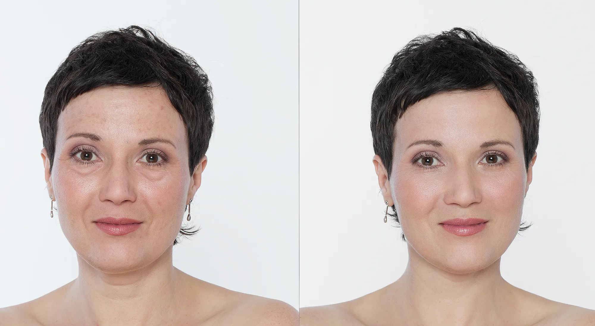 hum-arctic-repair-wrinkles-before-after