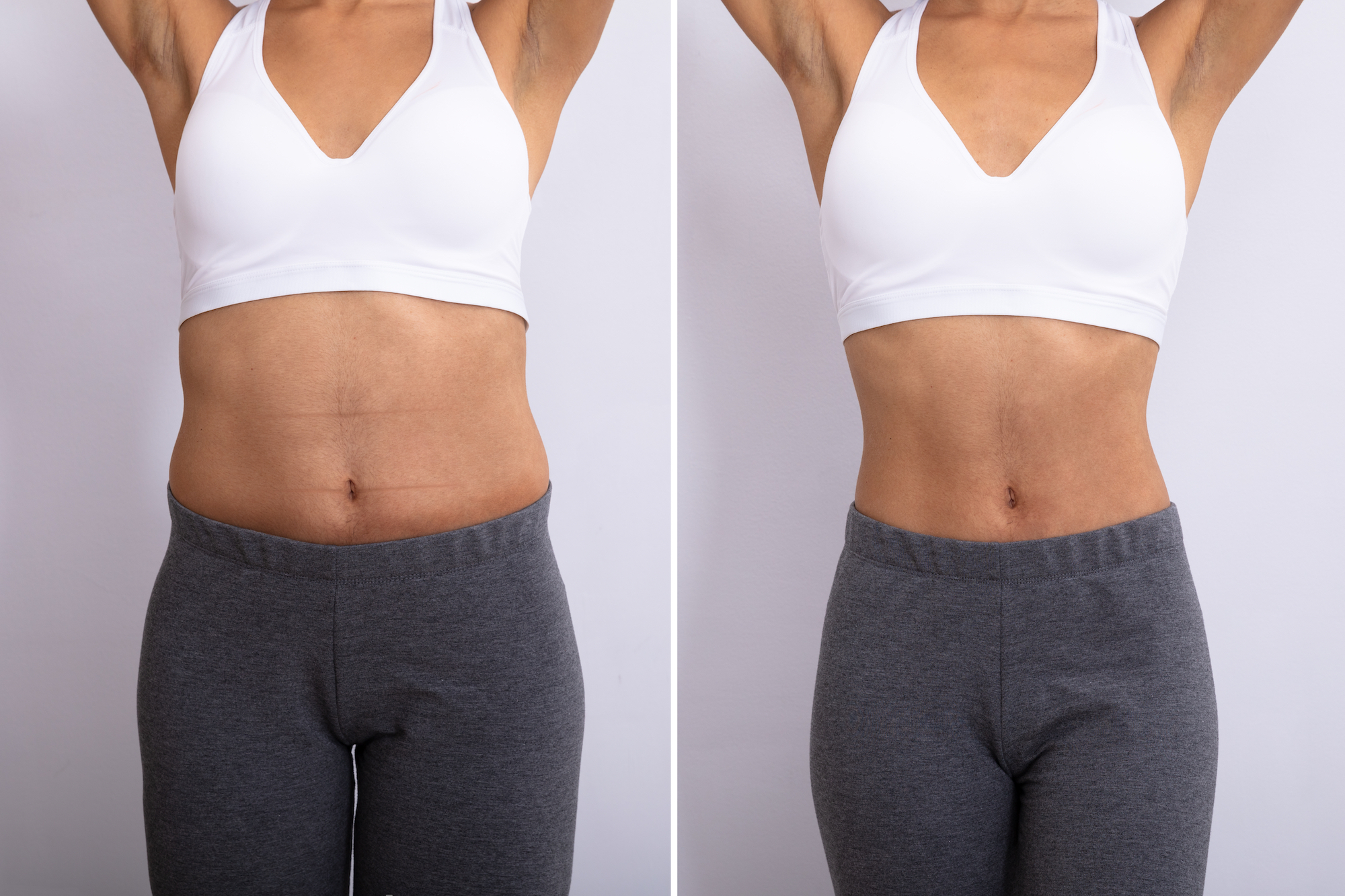 Before-After-Belly-Fat-Stock-Photo