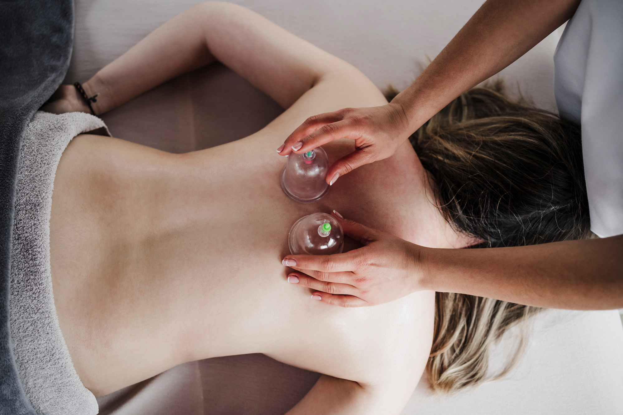 Cupping-Therapy-Stock-Photo