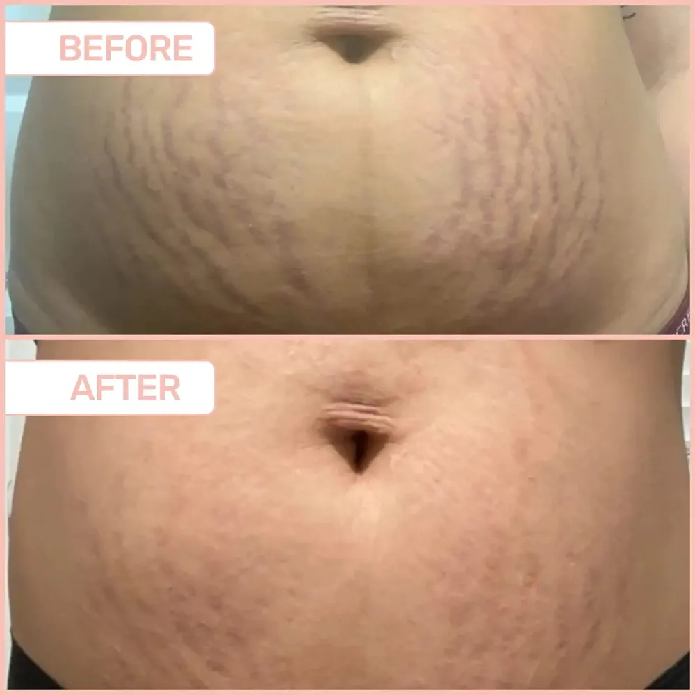 MA&Euml;LYS B-FLAT Belly Firming Cream