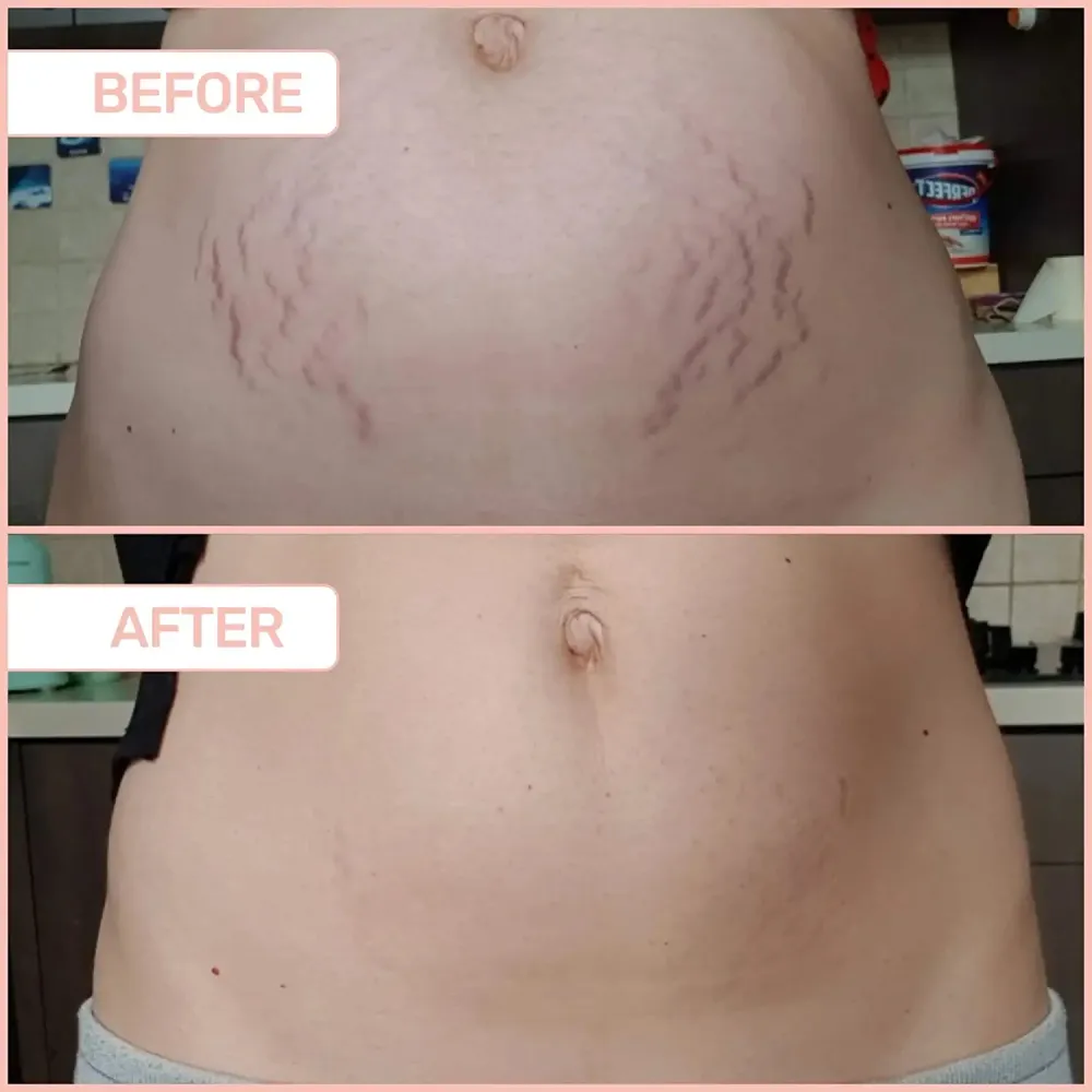 MA&Euml;LYS B-FLAT Belly Firming Cream