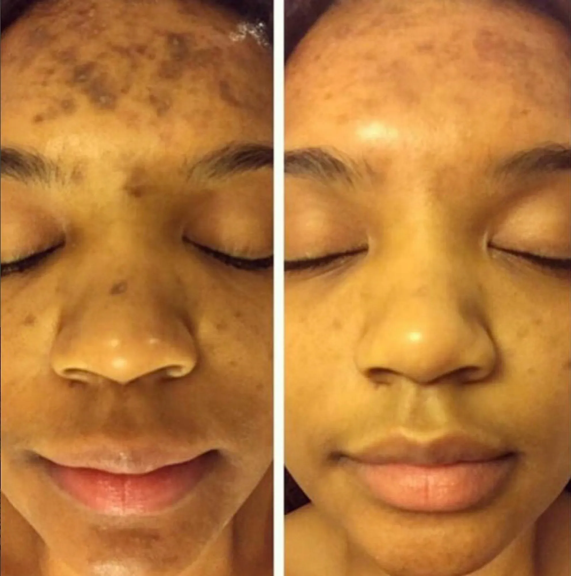 admire-my-skin-dark-spot-corrector