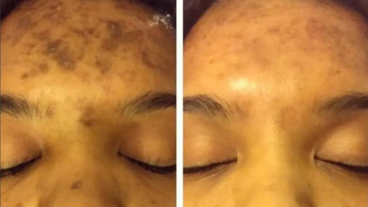 admire-my-skin-dark-spot-corrector