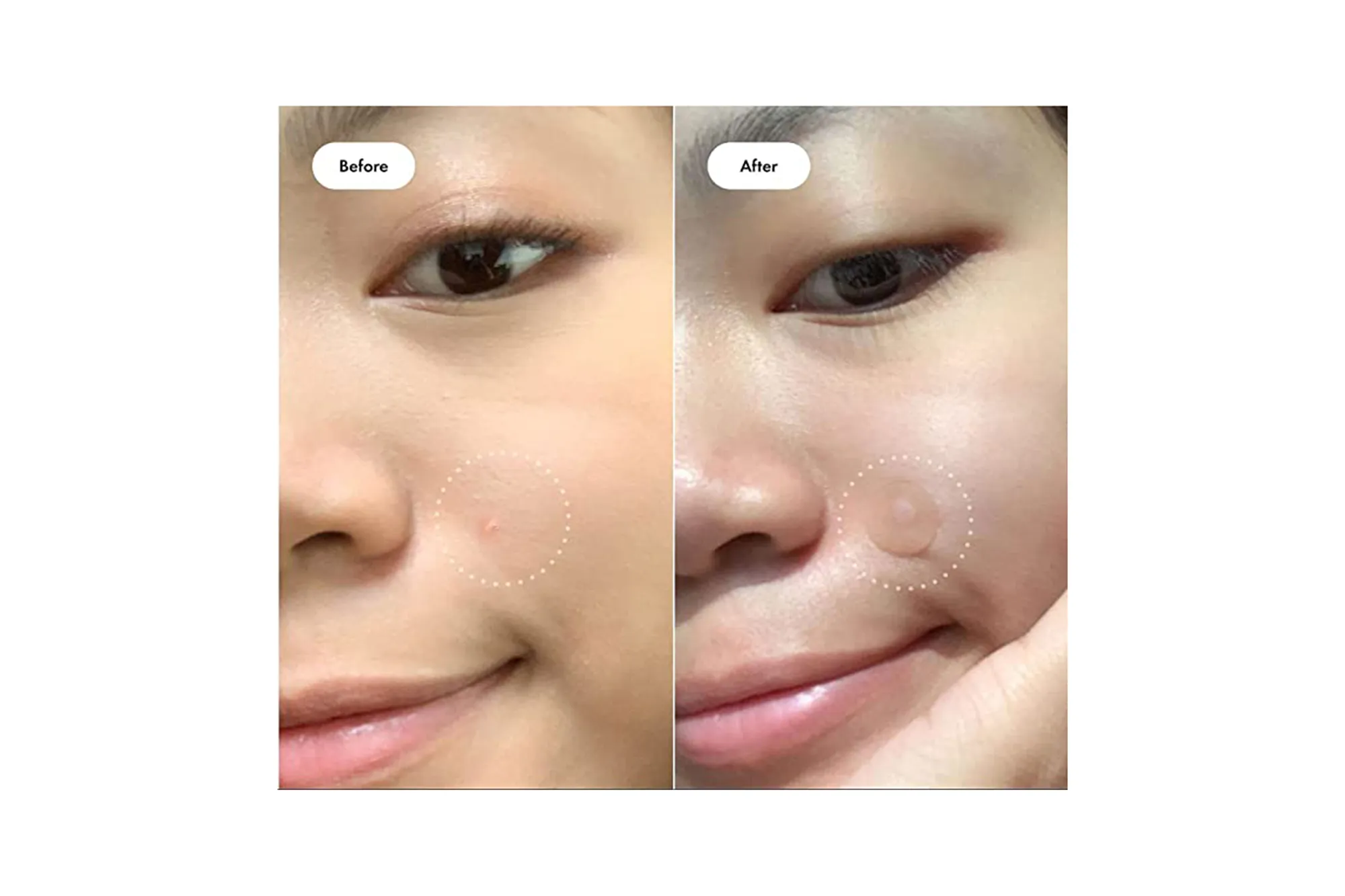 before after Mighty Patch