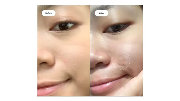 before after Mighty Patch