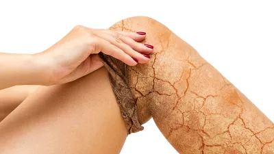 coco-eve-jelly-massage-mitt-dry-skin