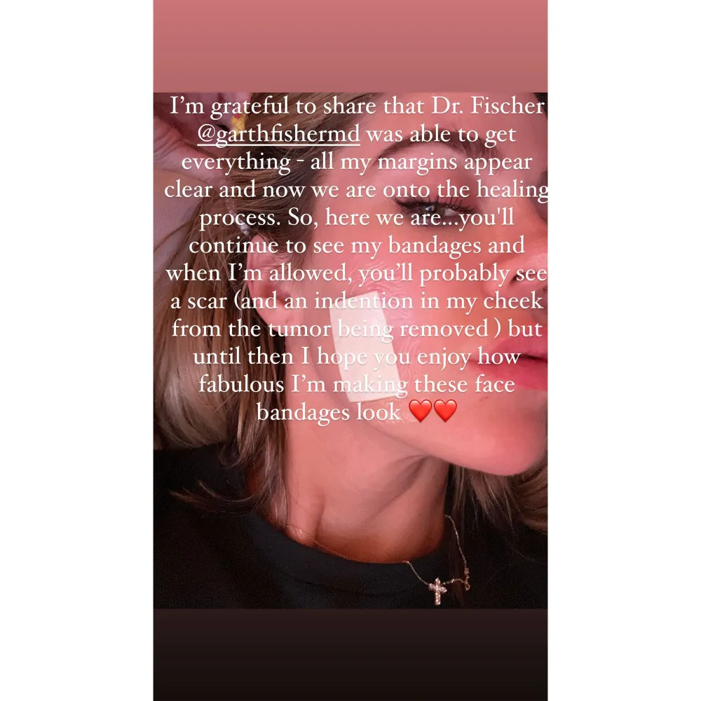 Khloe Kardashian Reveals She Had Surgery to Remove 'Rare' Face Tumor