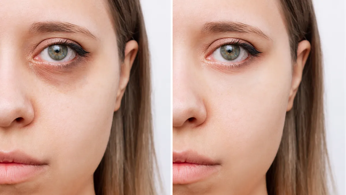 amazon-holiday-beauty-haul-under-eye-circles