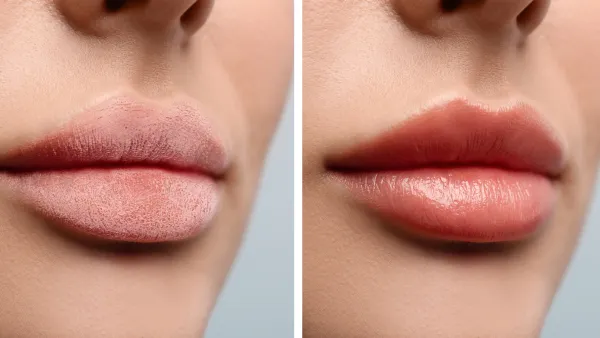 amazon-nooni-lip-oil